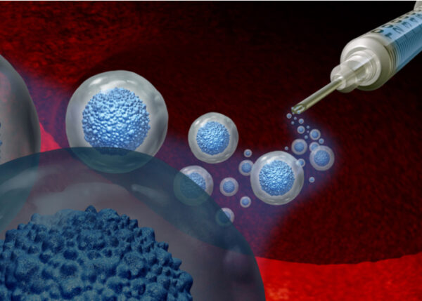 Stem Cell Treatment for Arthritis